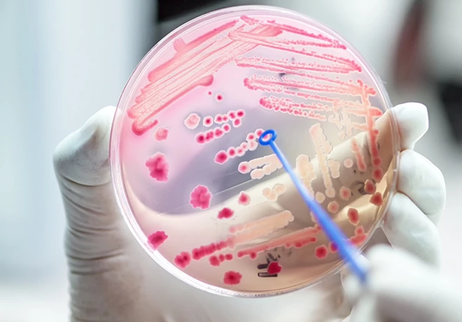 Bakterienkulturen Der Darmflora-Aufbau nach Antibiotika ist häufig nötig